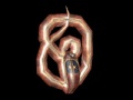 Thumbnail for version as of 13:22, 10 November 2004